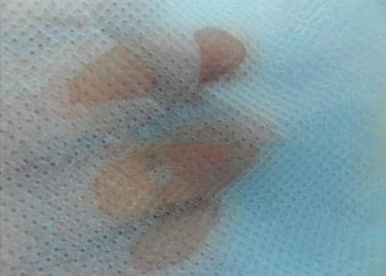 comprar Tela não tecida Nontoxic Eco de SMS - hidrofóbica amigável Waterproof para tecidos online manufacture